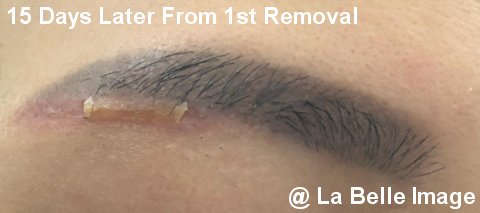 Permanent Make Up Eyebrows 15 Days Later From 1st Removal